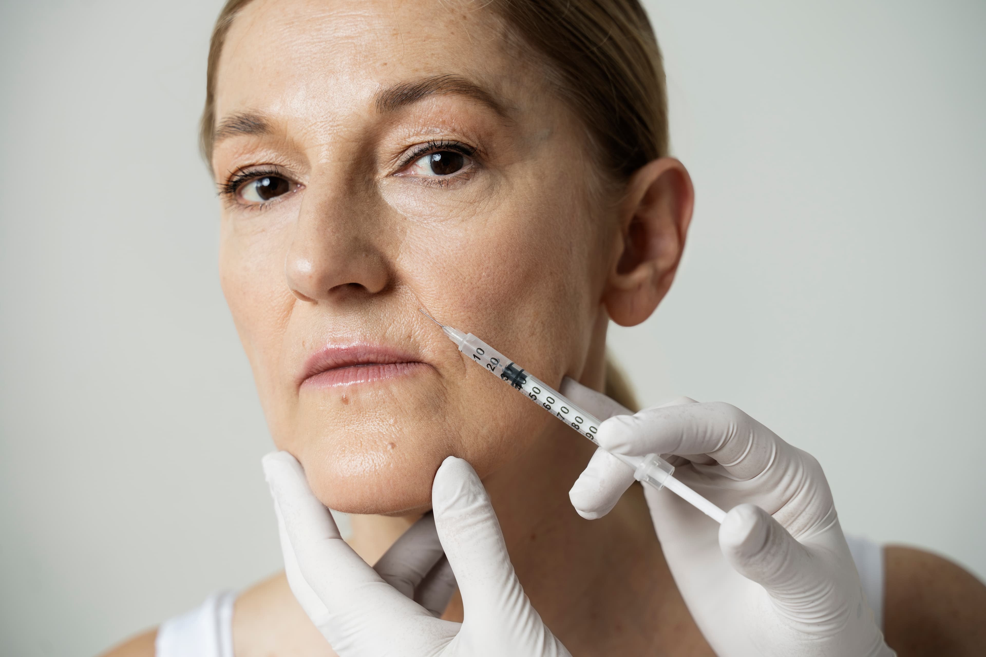 Profhilo Treatment: Complete Guide to Injectable Skin Hydration 2025