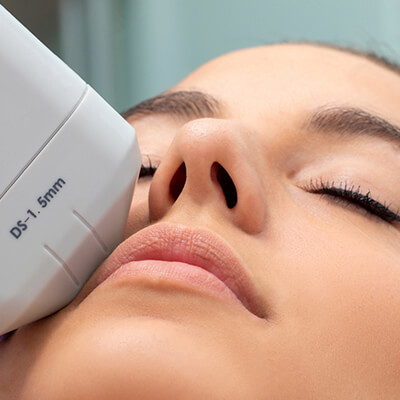 hifu treatment
